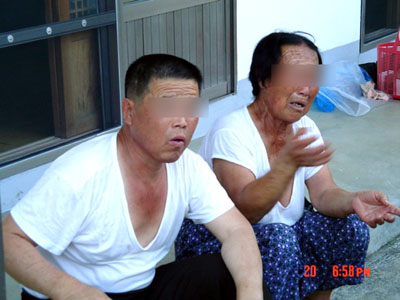 일제말기 남편이 한밤중 자다가 강제로 납치되어 일본 히로시마에서 원폭에 피폭 당한 후 실명되었으며, 큰아들 역시 양쪽 눈이 실명되어 시각장애인이 되었다며 원통해하는 어머니. [사진출처] 한국원폭2세환우회