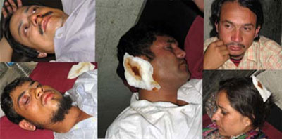 마오주의 반군의 공격으로 부상을 당한 노조 지도자들