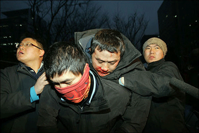 코스콤 농성장 침탈로 많은 노동자들이 다쳤다. 